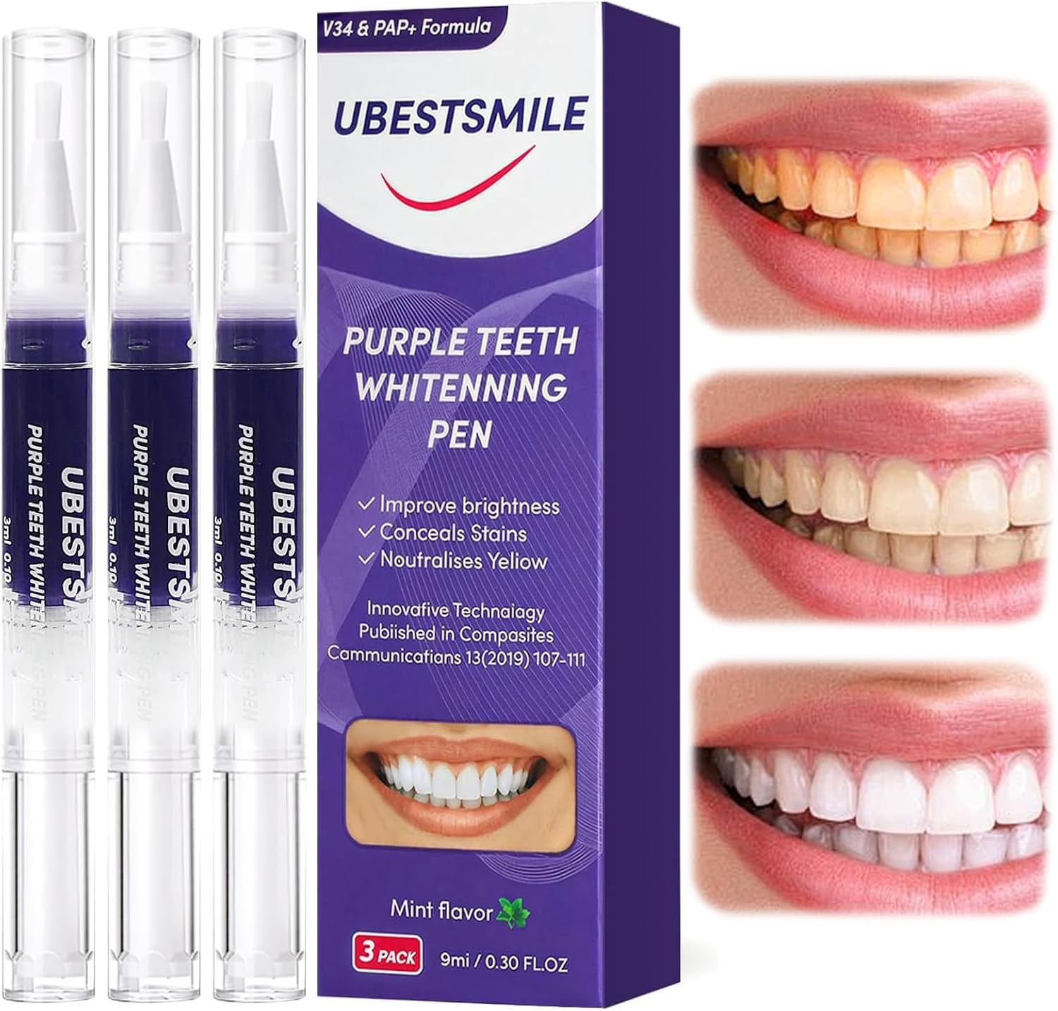 Teeth Whitening Pens - قلم تبييض الأسنان الأرجواني UBESTSMILE V34&PAP+